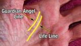 Guardian angel line